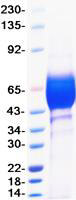 Recombinant SARS-CoV-2 Spike NTD Protein