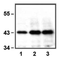 anti-ERK1 (E19) mAb dilution used in WB of HEK293 and Jurkat cell lysate