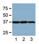 anti-gadph mAb dilution used in WB of lane tissue lysates from human etc.