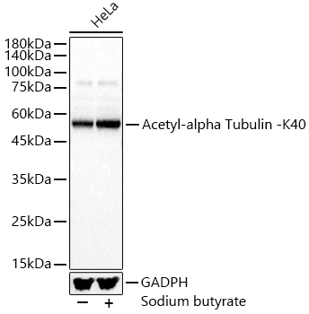 Acetyl-alpha Tubulin -K40 Rabbit pAb