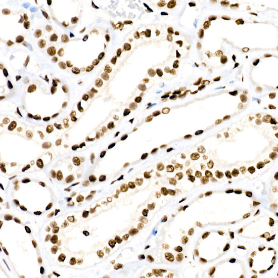 RBBP5 Rabbit mAb