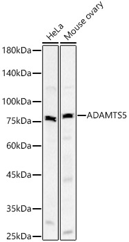 ADAMTS5 Rabbit mAb