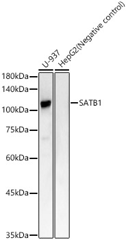 SATB1 Rabbit mAb