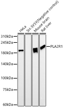 PLA2R1 Rabbit mAb