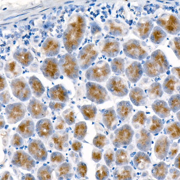 Pepsinogen I (PG I) Rabbit mAb