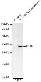IL12B Rabbit mAb