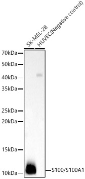 S100/S100A1 Rabbit mAb