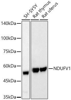 NDUFV1 Rabbit mAb