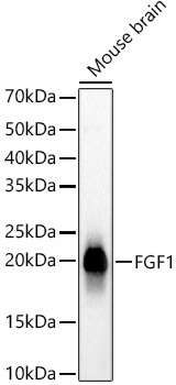 FGF1 Rabbit mAb