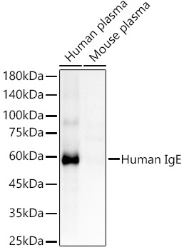 Human IgE Rabbit mAb