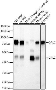 GALC Rabbit mAb