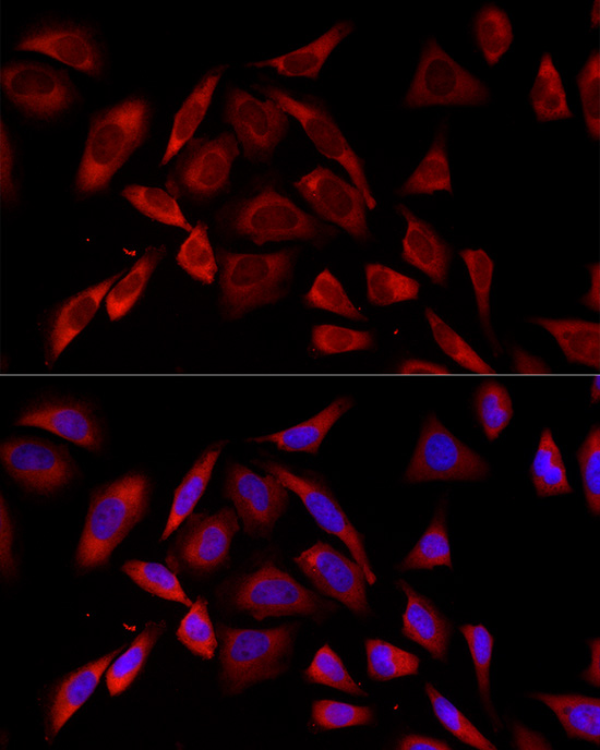 PKC alpha Rabbit mAb