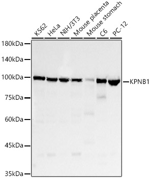 KPNB1 Rabbit mAb