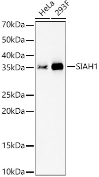 SIAH1 Rabbit mAb