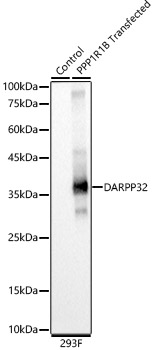 DARPP32 Rabbit mAb