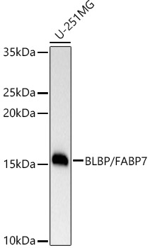 BLBP/FABP7 Rabbit mAb