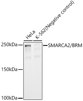 SMARCA2 / BRM Rabbit mAb
