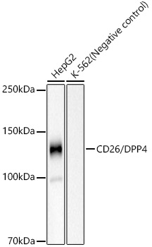CD26/DPP4 Rabbit mAb