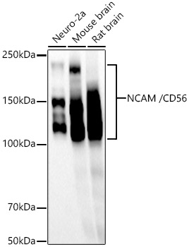 NCAM /CD56 Rabbit mAb