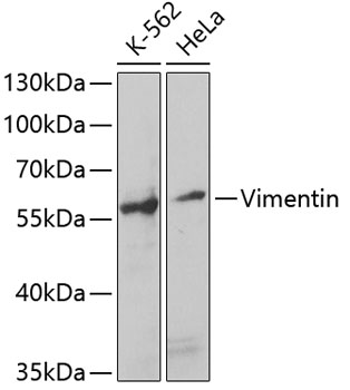 Vimentin Rabbit pAb