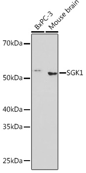 SGK1 Rabbit mAb