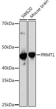 PRMT1 Rabbit mAb