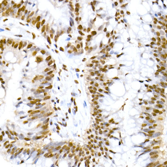 Phospho-MDM2-S166 Rabbit mAb