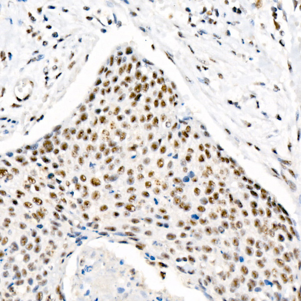 Phospho-Chk2-T68 Rabbit mAb