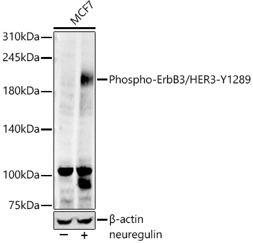 Phospho-ErbB3/HER3-Y1289
