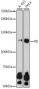 [KO Validated] RB Rabbit pAb