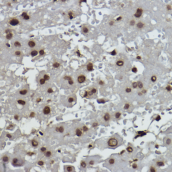 Formyl-Histone H2B-K108 Rabbit mAb