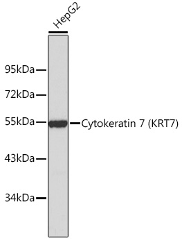 Cytokeratin 7 (KRT7) Rabbit pAb