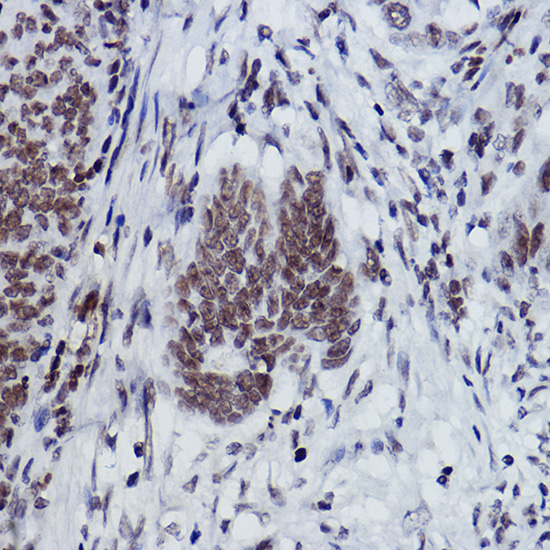 MonoMethyl-Histone H2B-K116 Rabbit mAb