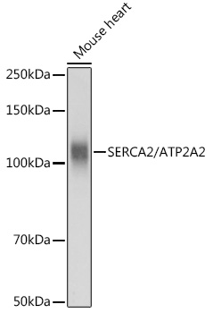 SERCA2/ATP2A2 Rabbit pAb
