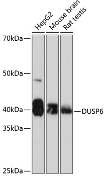DUSP6 Rabbit mAb