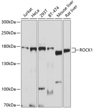ROCK1 Rabbit pAb