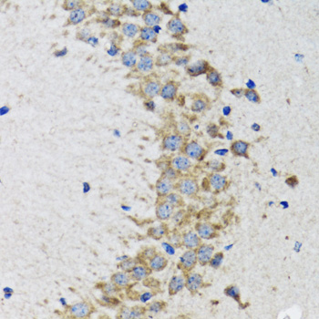 CDK1 Rabbit pAb