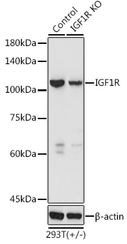 [KO Validated] IGF1R Rabbit pAb