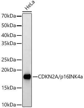 [KO Validated] CDKN2A/p16INK4a Rabbit pAb