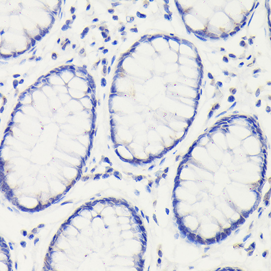 p53 Rabbit pAb