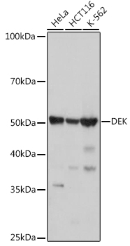 DEK Rabbit mAb