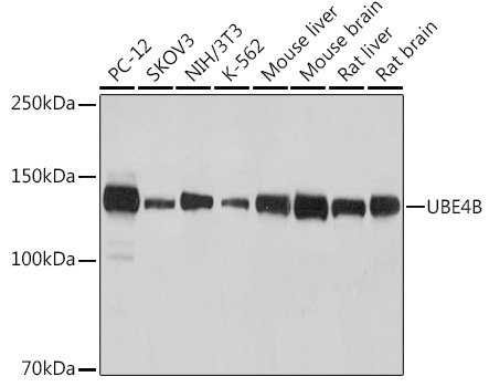 UBE4B Rabbit mAb