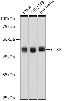CTBP2 Rabbit mAb