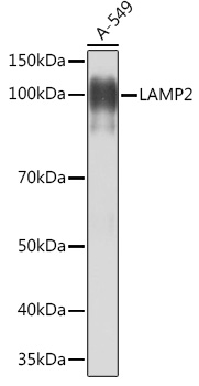 LAMP2 Rabbit mAb