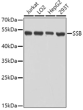 SSB Rabbit pAb