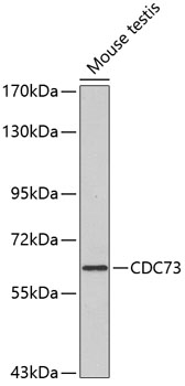 CDC73 Rabbit pAb