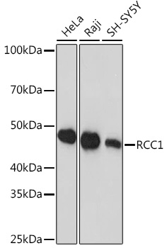 RCC1 Rabbit mAb