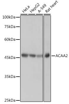 ACAA2 Rabbit mAb