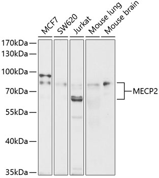 [KO Validated] MECP2 Rabbit pAb