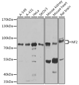 [KO Validated] NF2 Rabbit pAb